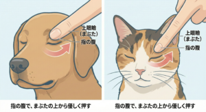 迷走神経刺激による発作の軽減